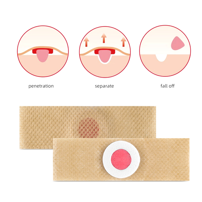 6PCS Voetverzorging Sticker Pa - Detox Foot Patch recensie en prijs